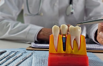 A dental implant surgery procedure