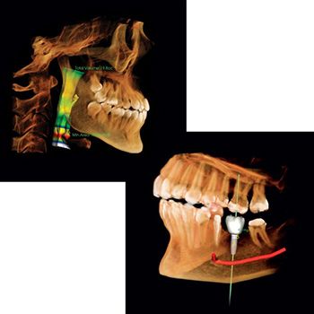 digital dental scan