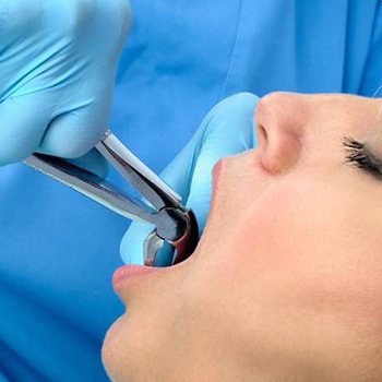 Woman having tooth extracted