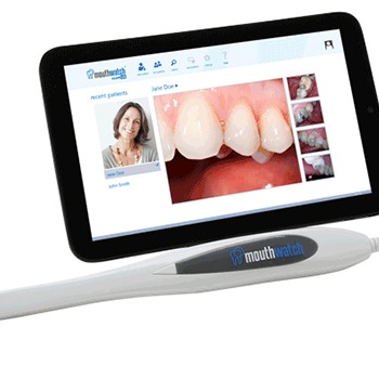 intraoral camera