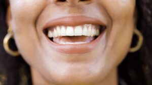 Close-up of a woman’s smile